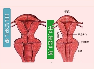 宫腔线分离图片